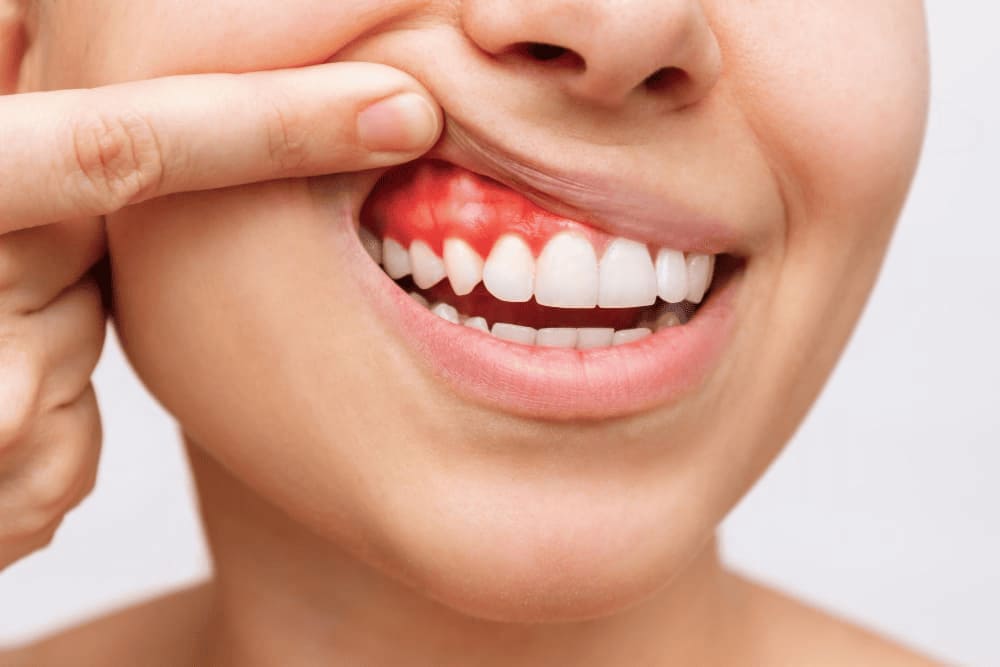 consultas-odontologicas-en-linea
